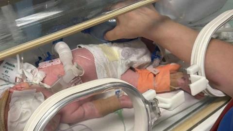 Ιατρικό επίτευγμα στη Λάρισα: έσωσαν την όραση σε προωράκι 600 γραμμαρίων