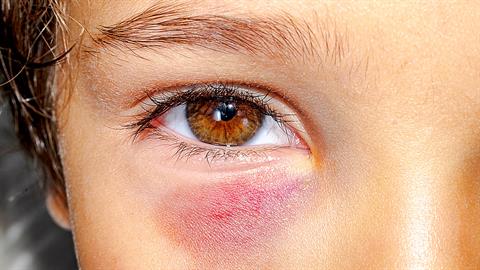 16χρονος ξυλοκόπησε άγρια μαθητή της Γ’ Δημοτικού - είχε πάνω του μαχαίρι