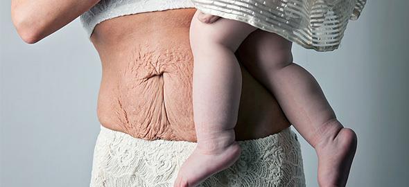 12 γυναίκες δείχνουν πώς πραγματικά είναι το σώμα τους μετά την εγκυμοσύνη