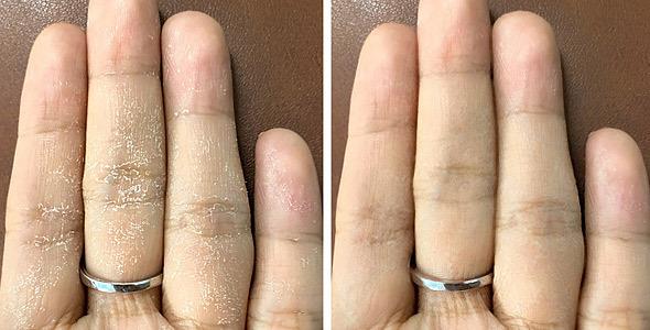 5 τρόποι να κρατήσεις τα χέρια σου απαλά παρά τα πλυσίματα και τις χλωρίνες 