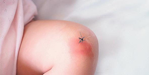 Πώς να κρατήσετε τα επικίνδυνα τσιμπήματα των κουνουπιών μακριά από τα μωρά